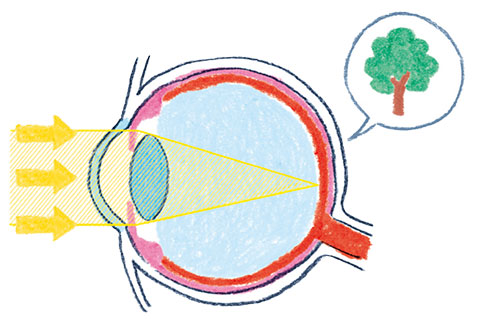 近視などの異常は、早い対応がカギ【子どもの目を守る！・２】の画像1