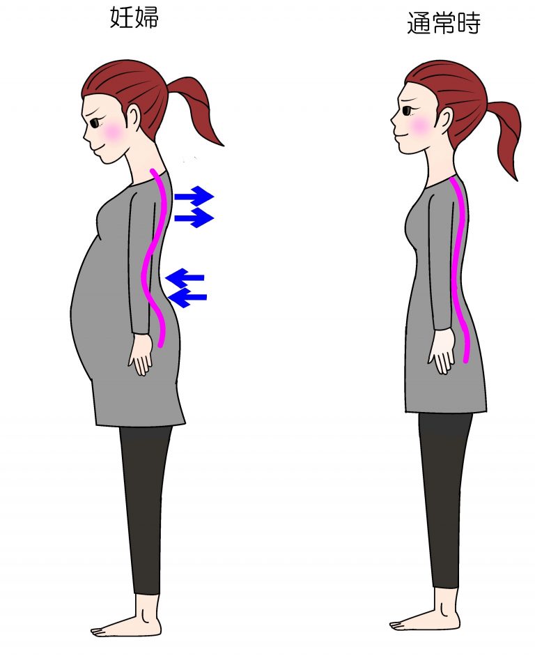 妊娠 後期 背中 の 痛み