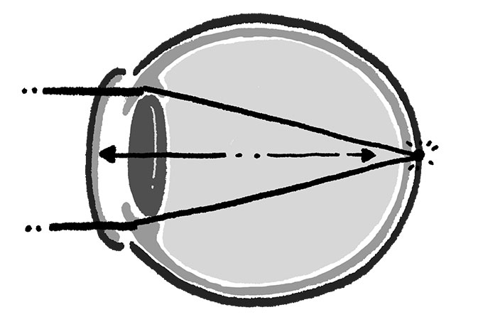 【子どもの「近視」】わが子は大丈夫？ 近視になりやすい子チェックリストの画像2